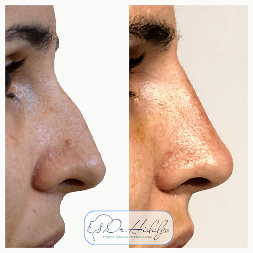 Clínica One Face. Medicina y Cirugia Estética Facial