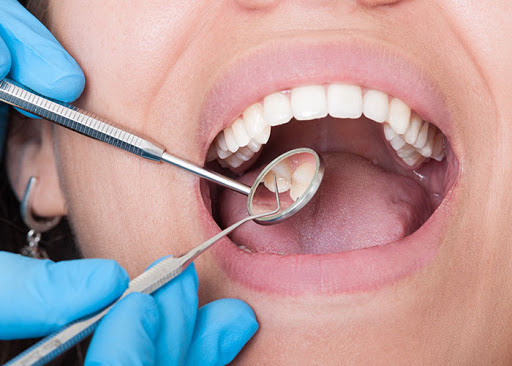 ACO Centro Odontológico Aragón, Estética Dental, Implantes Dentales